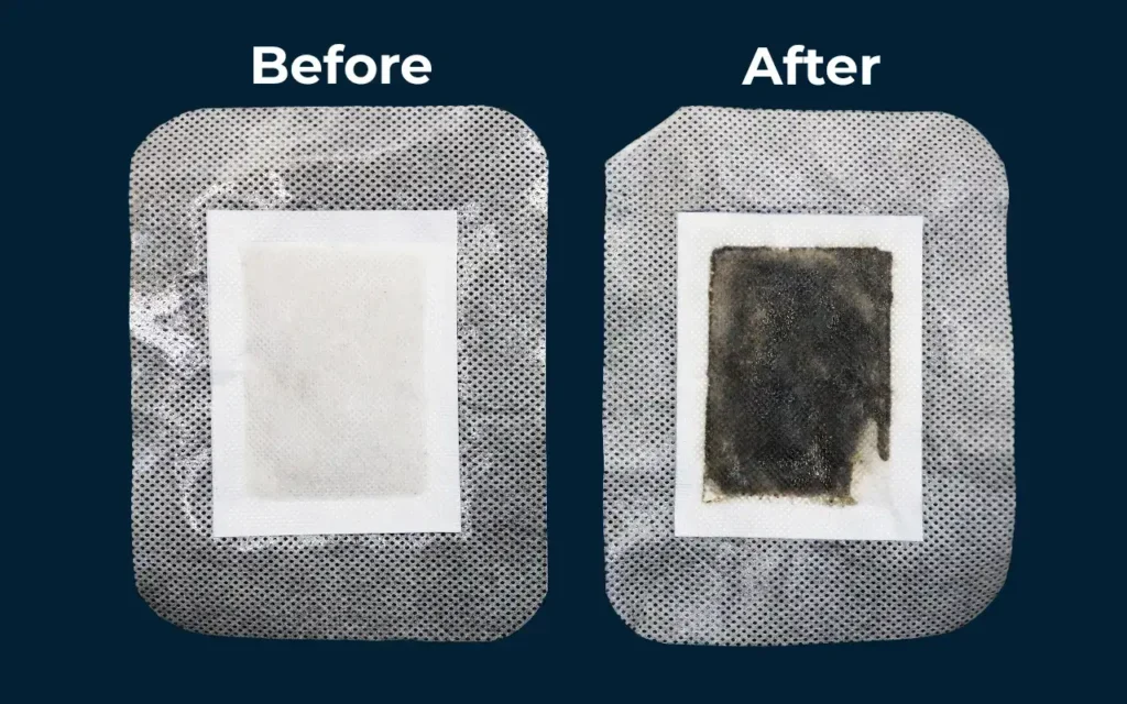 Xitox Foot Pads Before And After Results